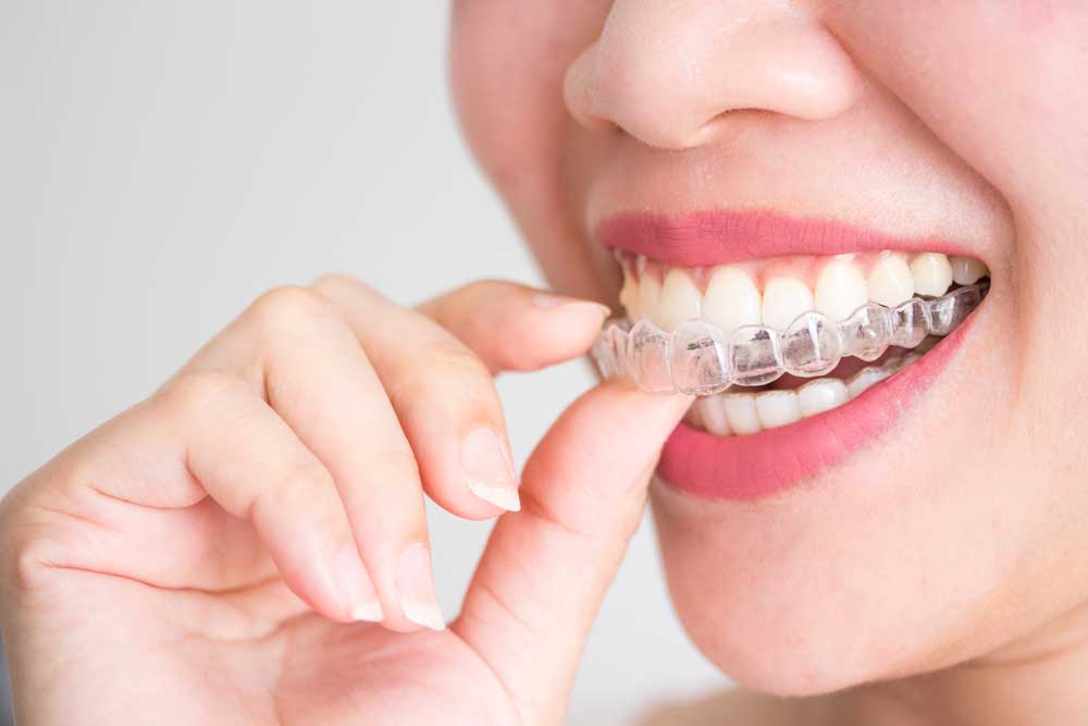 A woman taking invisalign braces out of her mouth.