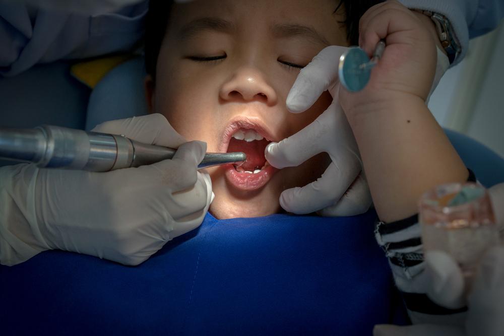 Fluoride Treatments