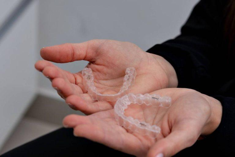 clear aligners vs braces