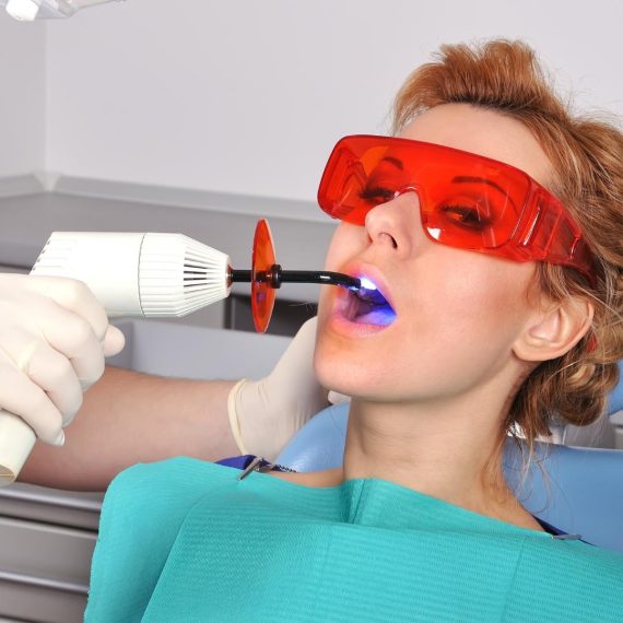 Dental Fillings