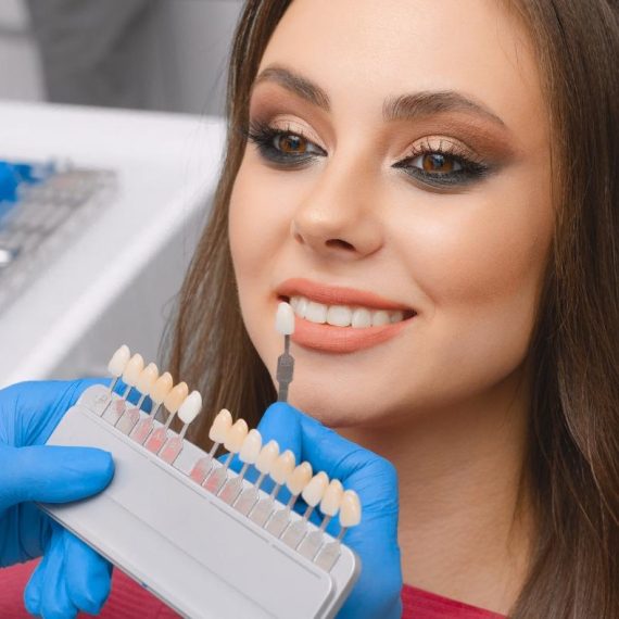 Dentist matching a veneer shade guide to a smiling woman's teeth